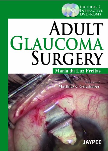 Adult Glaucoma Surgery by Maria Da Luz Freitas